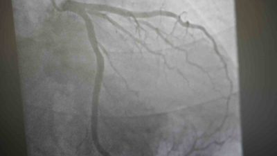 KARDİYOLOJİ UZMANI PROF. DR. UĞUR ARSLAN, D VİTAMİNİ ALMAK İÇİN