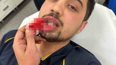 BURSA’DA HASTA TAŞIYAN AMBULANSIN ÖNÜNÜ KESEN TRAFİK MAGANDASI, ÖNCE ŞOFÖRE