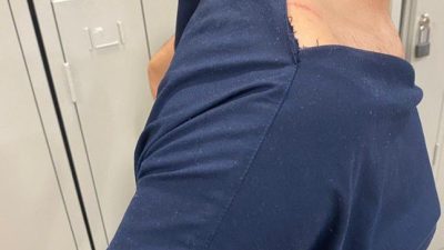 ELAZIĞ’DA HASTANEDE GÖREVLİ HEMŞİRE, HASTA YAKINLARI TARAFINDAN DARP EDİLDİ.