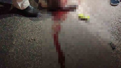 GÜNYÜZÜ İLÇESİNDE TRAFİK KAZASI, 1 YARALI