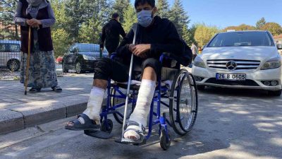 ESKİŞEHİR'DE YAKLAŞIK 3 YILDIR VÜCUDUNDA YARALAR ÇIKAN VE ÇÜRÜMELER OLUŞAN