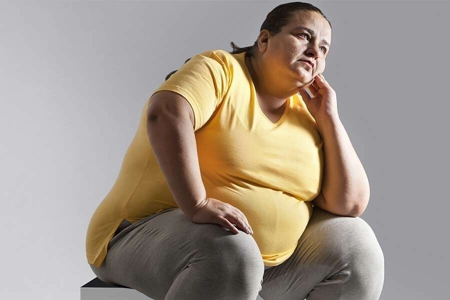 Obezitenin sağlığı bozacak düzeyde aşırı yağ dokusu birikimi ile karakterize