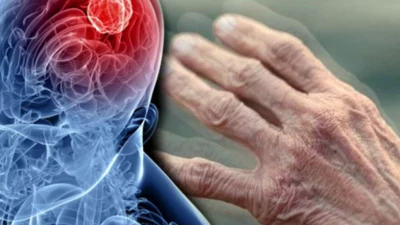 Nöroloji Uzmanı Prof. Dr. Sultan Tarlacı, Parkinson hastalığındaki artışın yalnızca